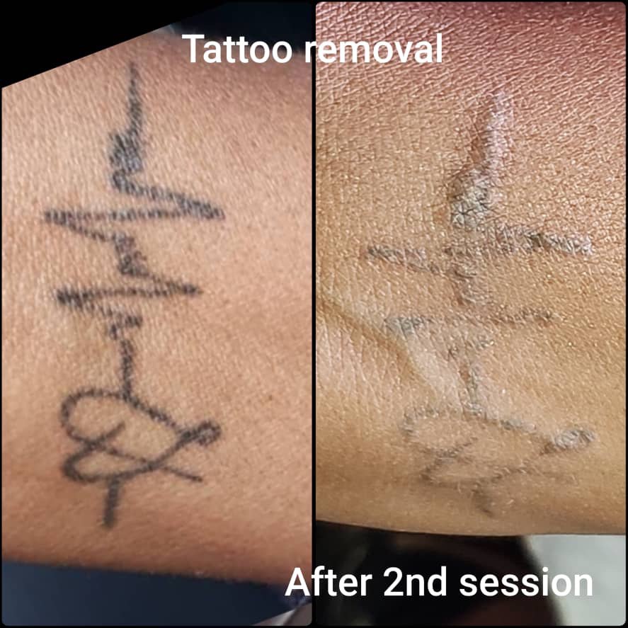picture of tattoo